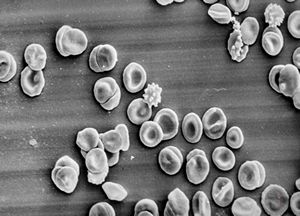 normal blood smear - SEM normal blood smear - SEM